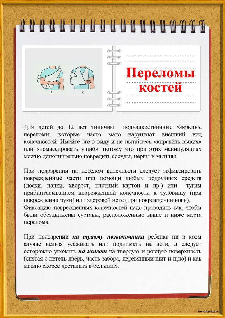 переломы костей